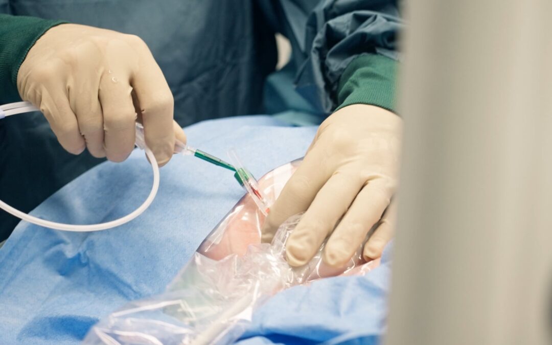Anlage ZVK – Lagekontrolle mittels intraatrialer EKG-Ableitung