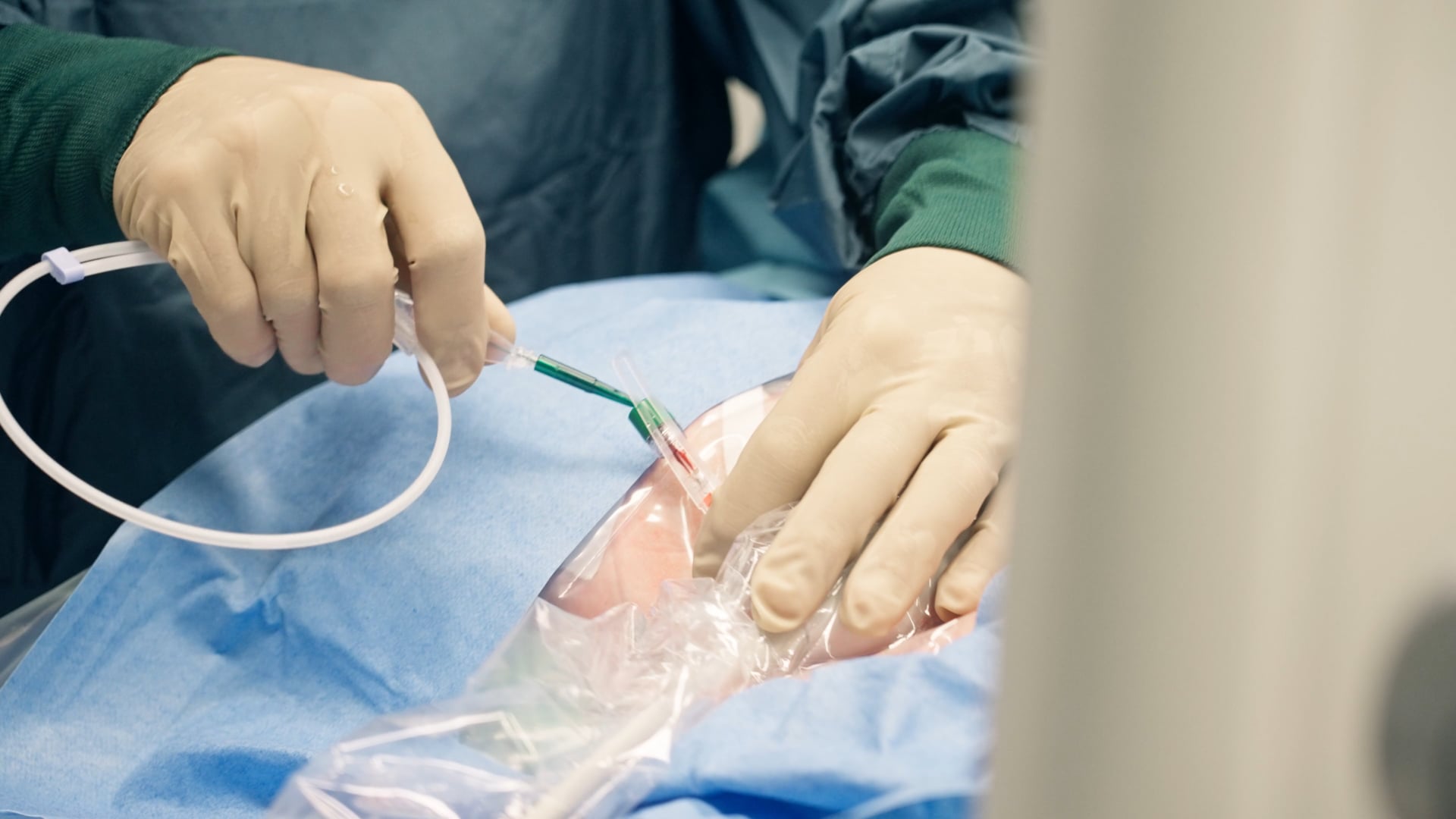 Anlage ZVK – Lagekontrolle mittels intraatrialer EKG-Ableitung