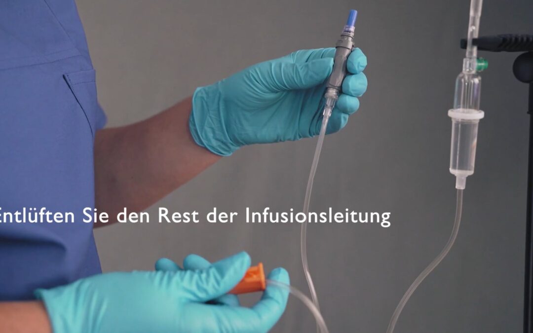 Geschlossenes System zur Verabreichung von Zytostatika – Applikation mittels Infusionspumpe