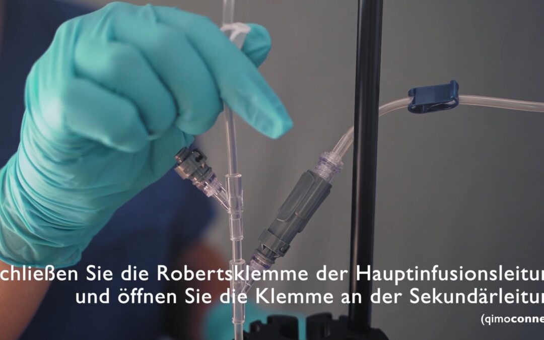 Geschlossenes System zur Verabreichung von Zytostatika – Applikation mittels Schwerkraftinfusion
