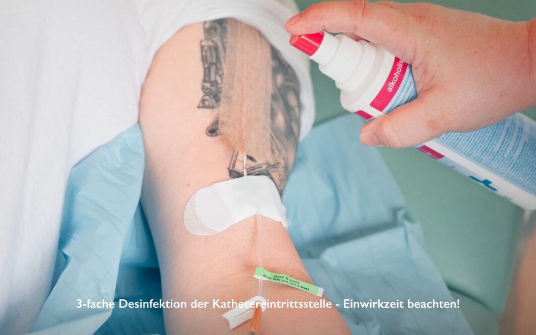 Pflege Midline-Katheter