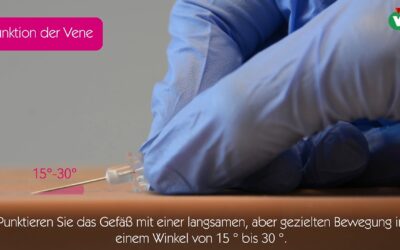 Tipps und Tricks bezüglich des Mikroseldinger-Einführbestecks