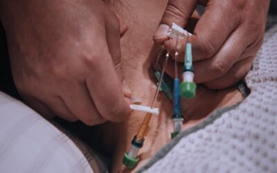 Pflege ZVK – Schritt für Schritt – Verwendung eines Hautklebers