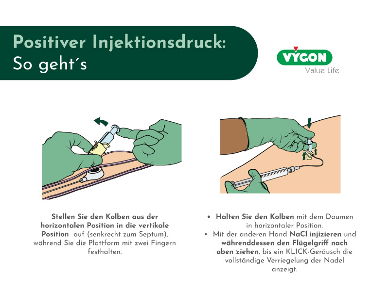 Funktionsweise des positiven Injektionsdrucks