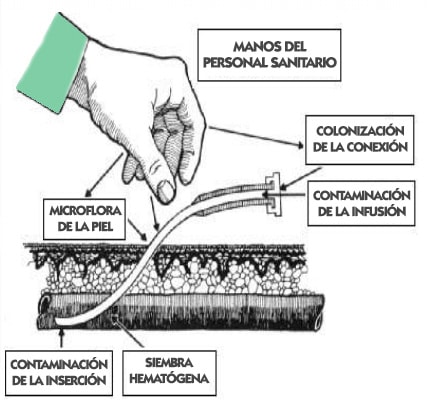 Cómo ahorrar dinero en suero - Palabra de Madre