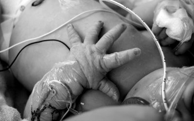 ¿Por qué la jeringa de bajo volumen (LDT) NO elimina los riesgos de sobredosis en neonatos?