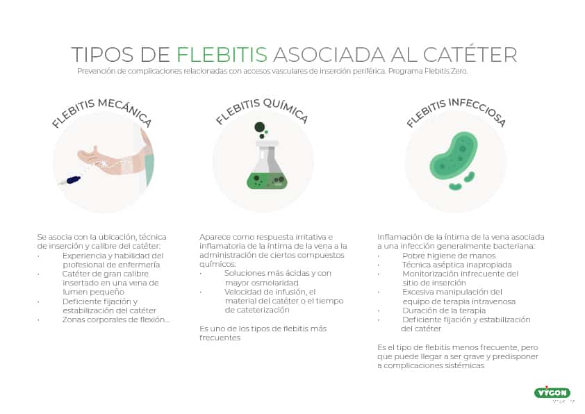 Tipología de flebitis
