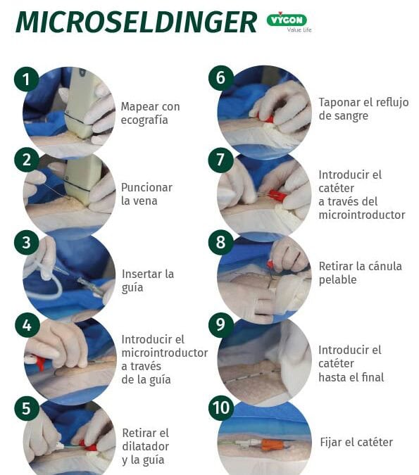 Póster técnica de inserción Microseldinger