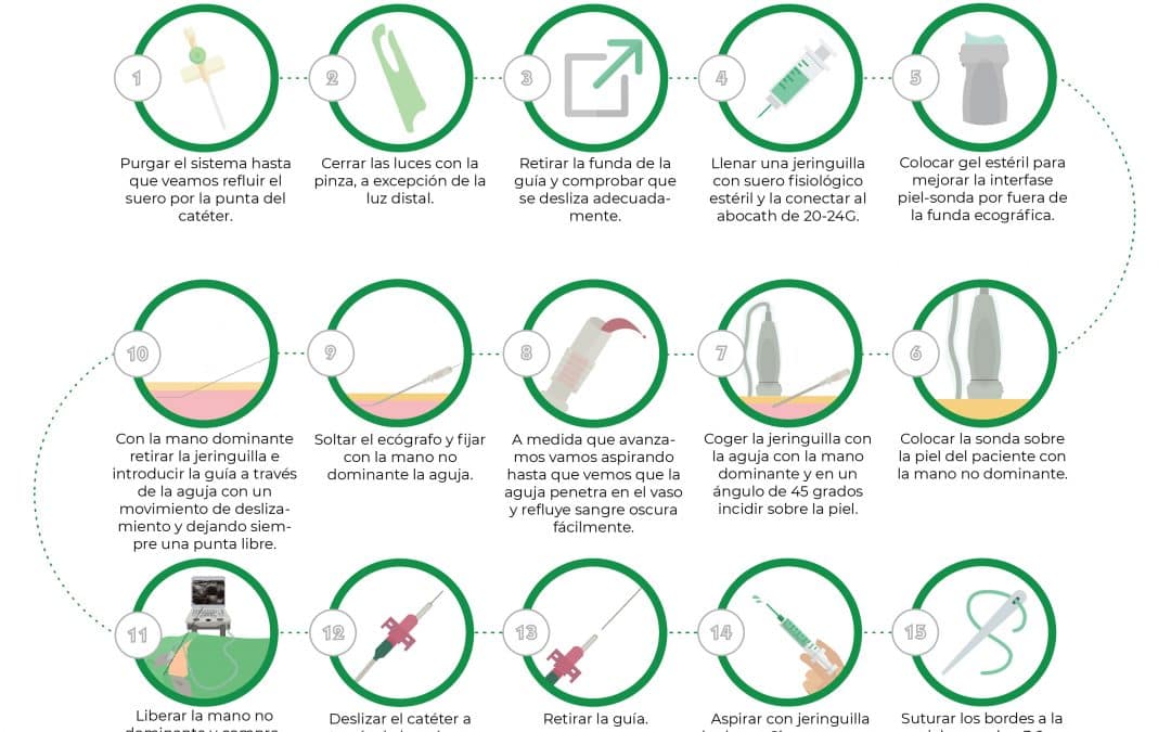 Paso a paso de la canalización venosa central ecoguiada