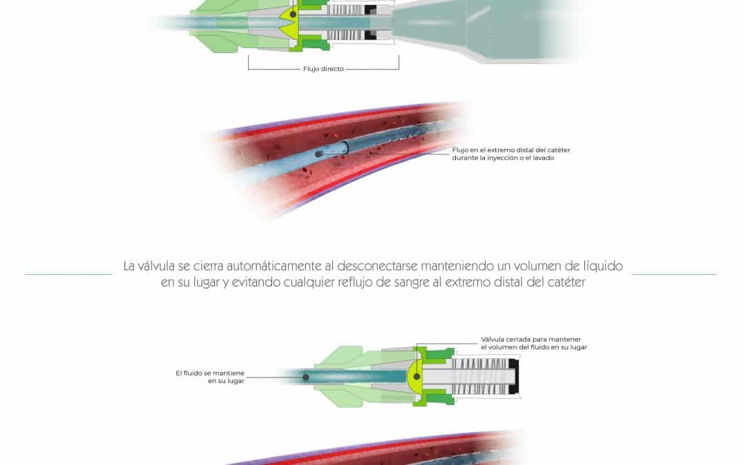 Funcionamiento válvula antirreflujo