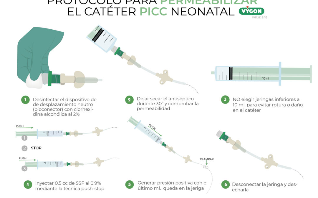 Protocolo para la permeabilizar el catéter PICC neonatal