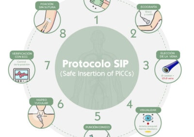 Protocolo SIP (Inserción Segura de PICCs)