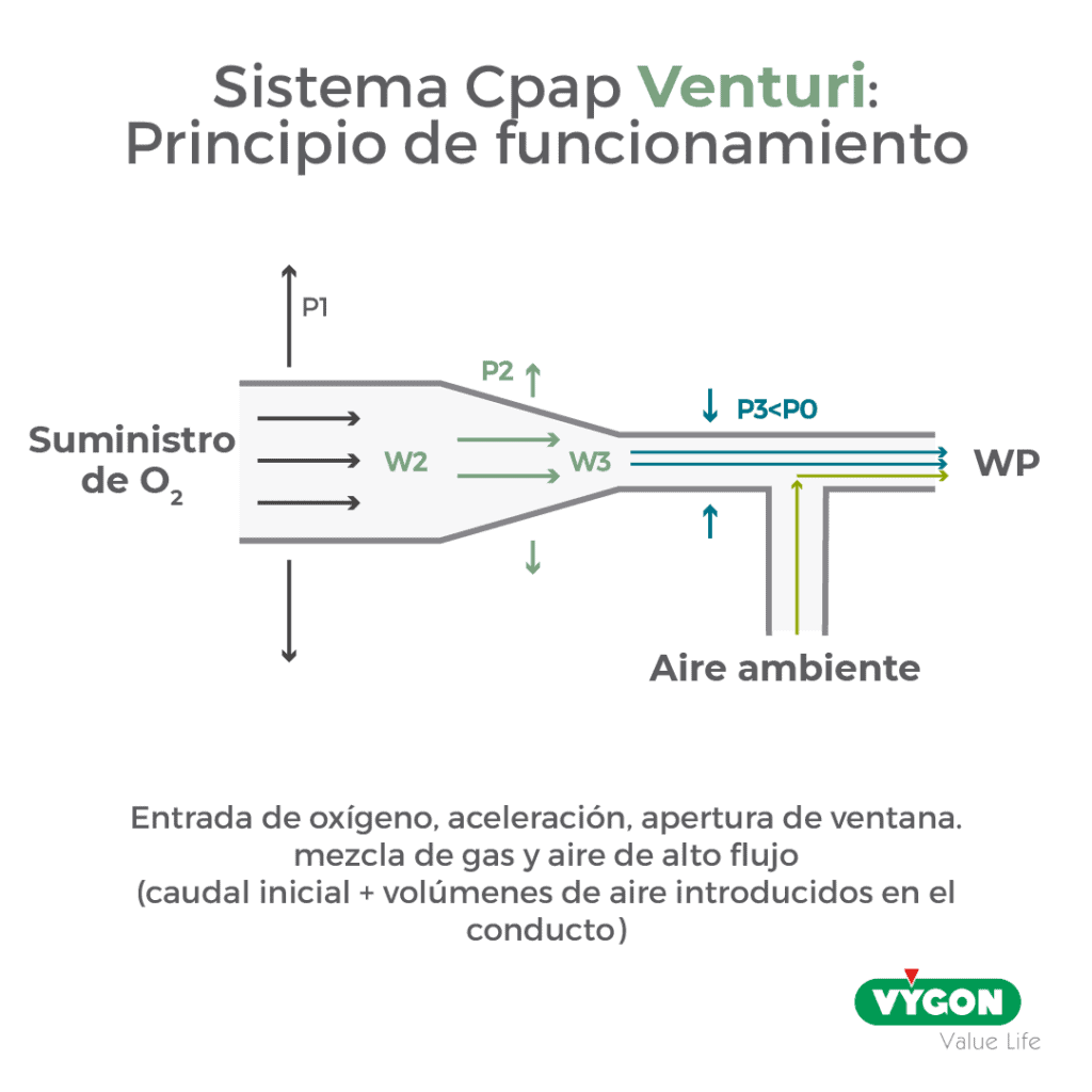 sistema cpap Venturi: principio de  funcionamiento