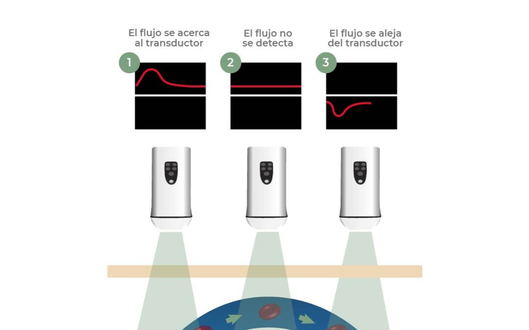 Cambios de interpretación con el Eco-Doppler