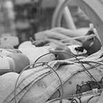 Inserción y manejo de las líneas medias en neonatos