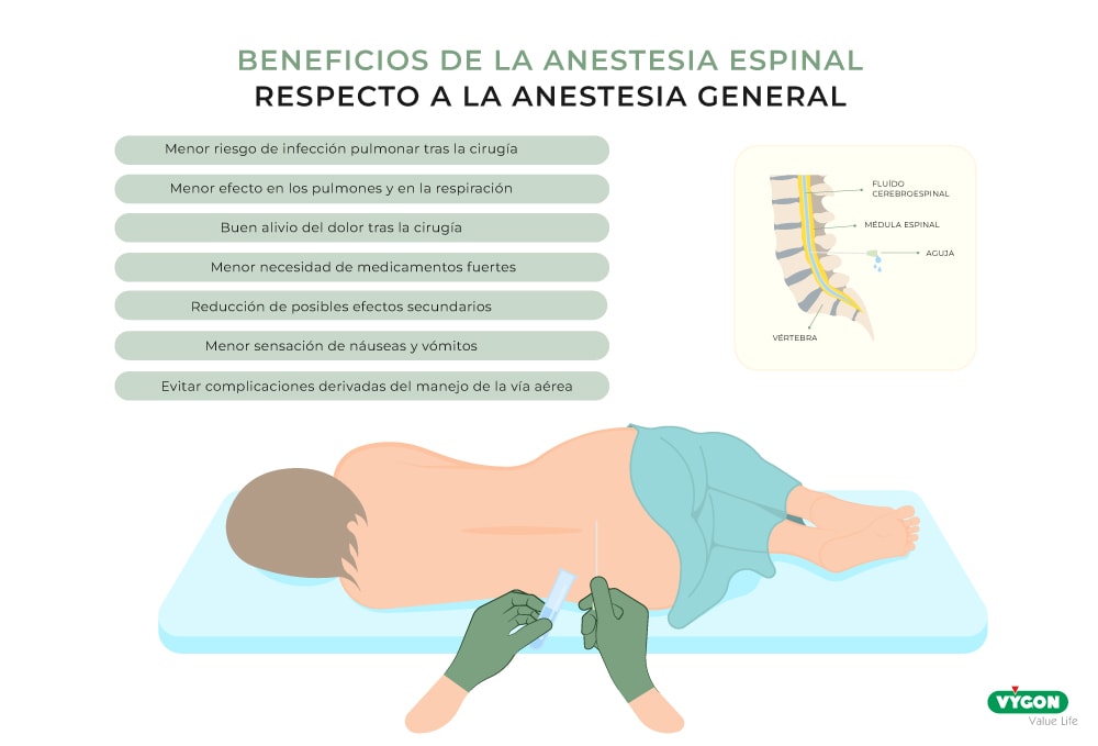 Beneficios de la anestesia espinal