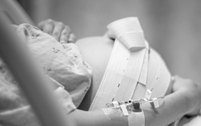 El papel de la anestesia epidural en el parto
