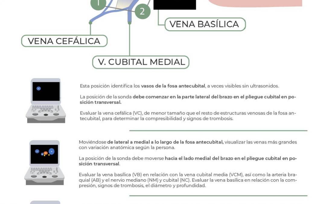 Protocolo de exploración ecográfica RaPeVa