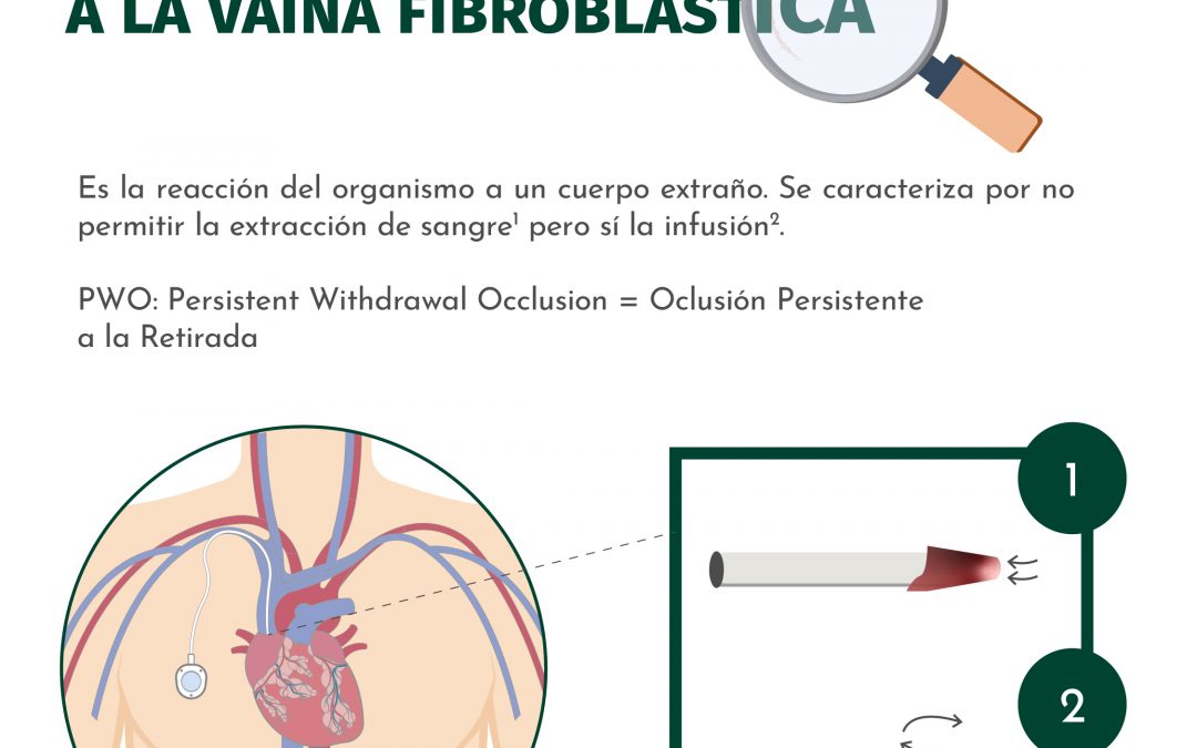 Un vistazo a la vaina fibroblástica