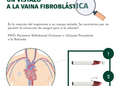 Un vistazo a la vaina fibroblástica