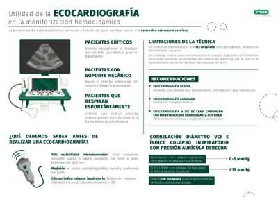 Utilidad de la ecocardiografía en la monitorización hemodinámica