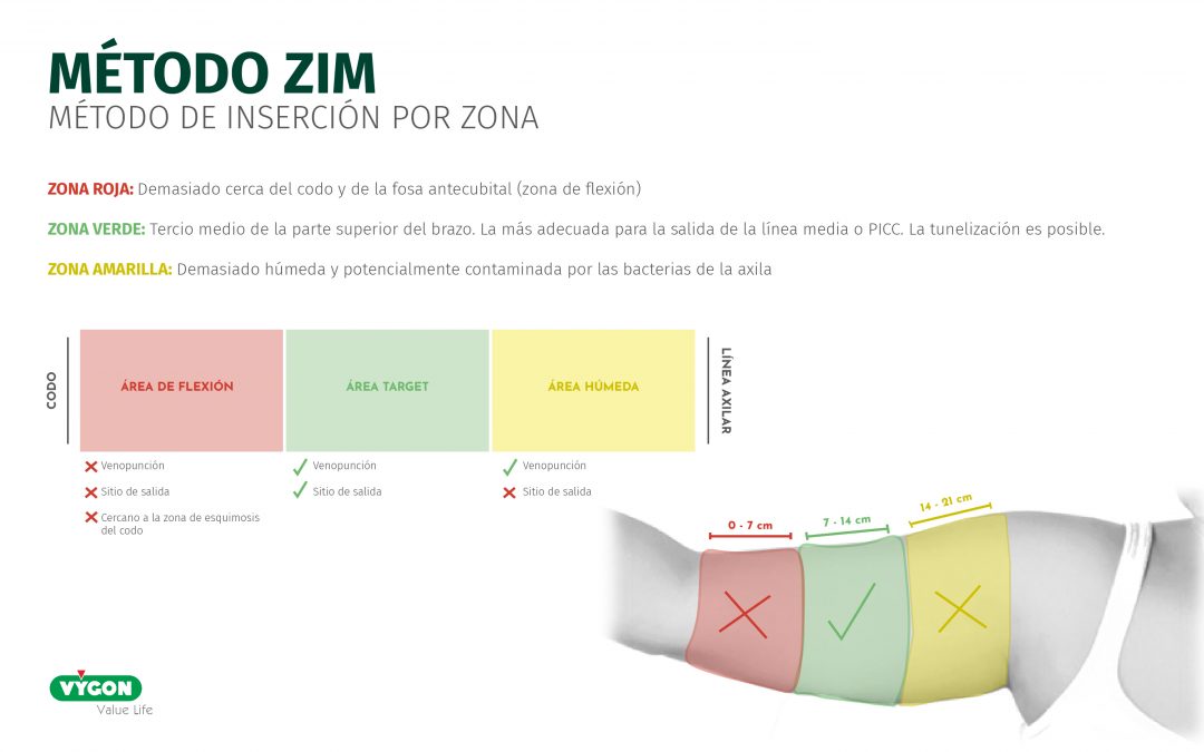 Método ZIM