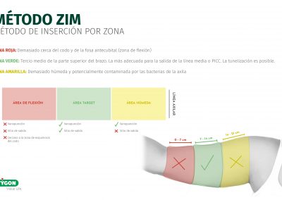 Método ZIM