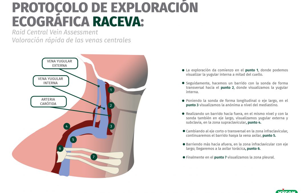 Protocolo de exploración ecográfica RaCeVa