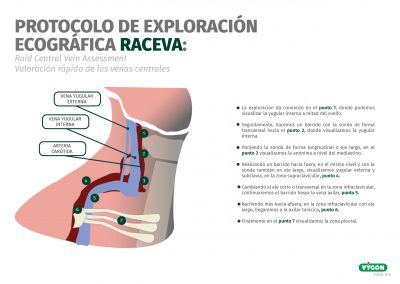 Protocolo de exploración ecográfica RaCeVa