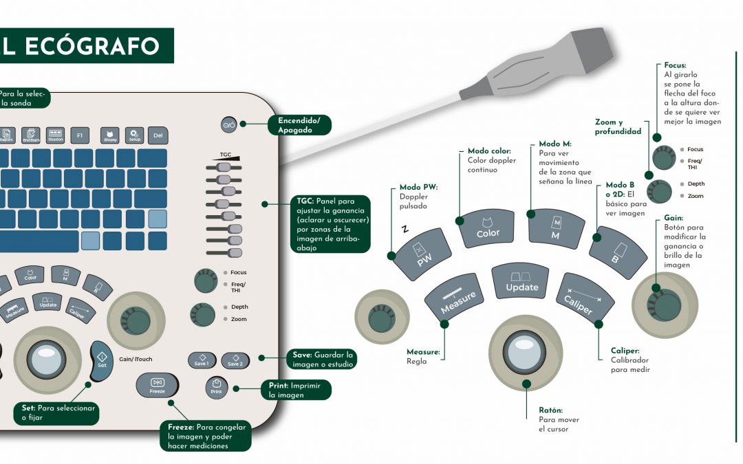 Botones y uso del ecógrafo