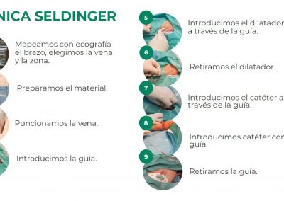 Póster técnica de inserción Seldinger pura