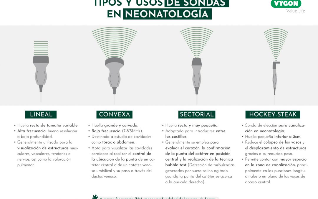 Tipos y usos de sondas en neonatología