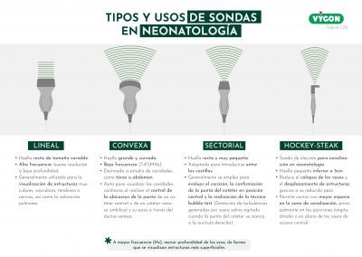 Tipos y usos de sondas en neonatología