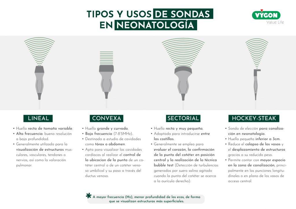 tipos y usos de sondas en ecografía