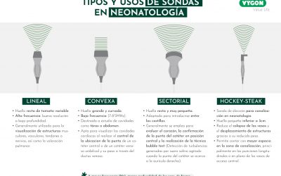 Tipos y usos de sondas en neonatología