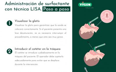 Administración de surfactante con técnica LISA. Paso a paso