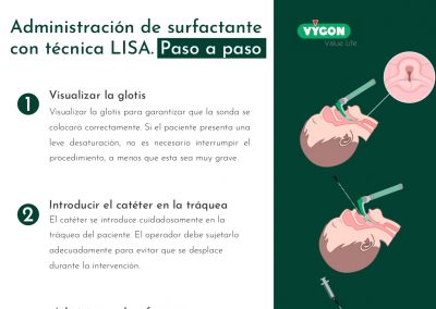 Administración de surfactante con técnica LISA. Paso a paso