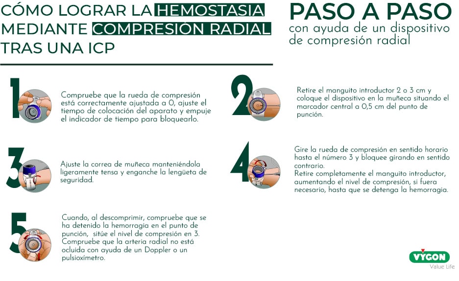 Infografía que describe los pasos a seguir con el fin de lograr la hemostasia mediante compresión tras una ICP con abordaje radial