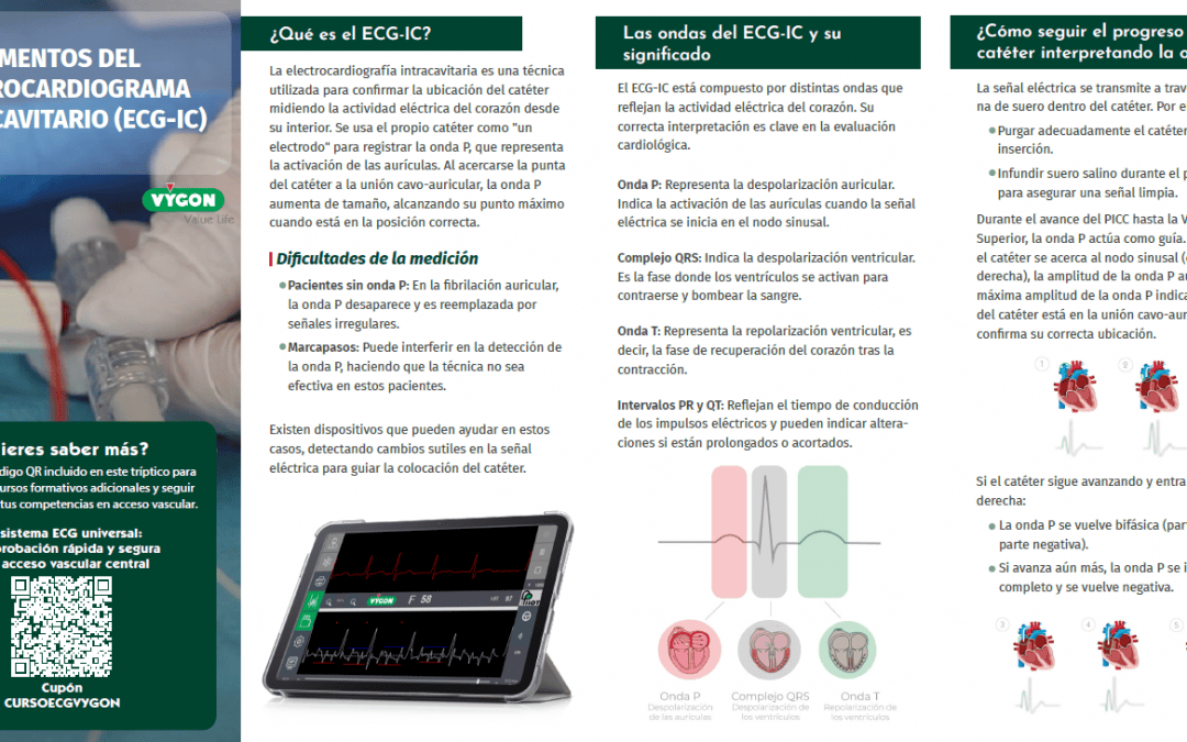 Fundamentos del electrocardiograma intracavitario (ECG-IC)