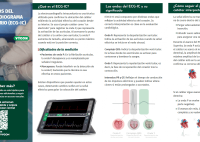 Fundamentos del electrocardiograma intracavitario (ECG-IC)