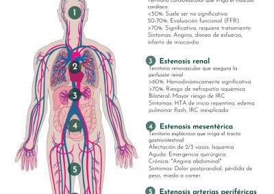Mapa anatómico de las estenosis vasculares