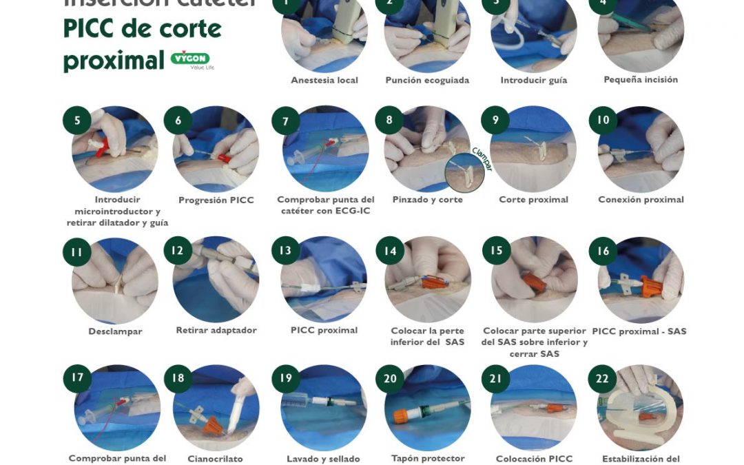 Inserción catéter PICC proximal