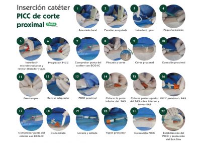 Inserción catéter PICC proximal