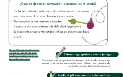 Comprobación de la posición de la sonda. Paso a paso