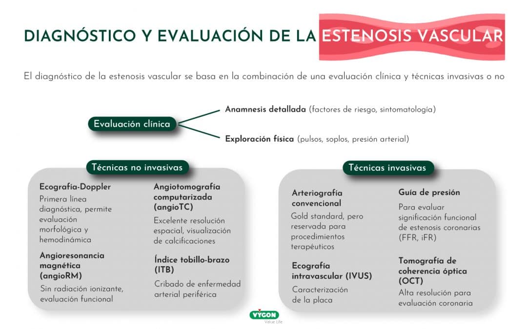 Diagrama diagnóstico y evaluación de la estenosis