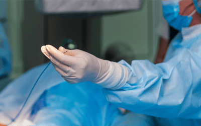 Cómo optimizar las angioplastias y mejorar los resultados clínicos gracias a los dispositivos de inflado rápido