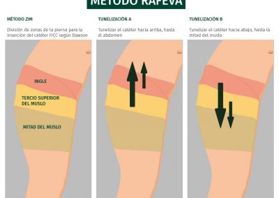 Método RaFeVa