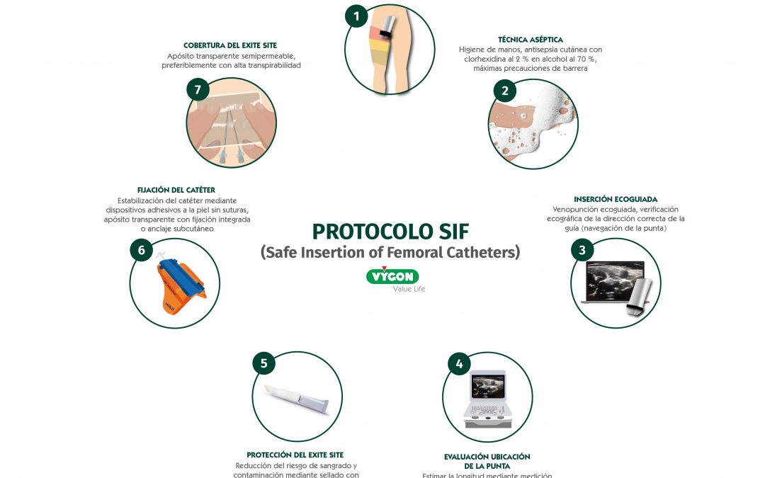 Protocolo SIF: Safe Insertion of Femoral Catheters
