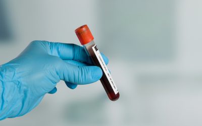 Extracciones de sangre con un catéter midline: ¿se puede o no se puede?