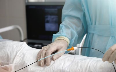 Fuga en el punto de inserción del catéter midline o PICC: ¿qué está pasando?
